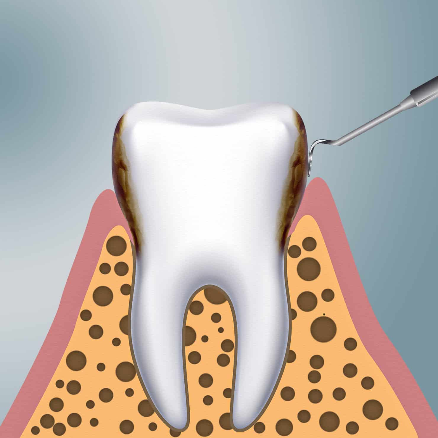 procedure